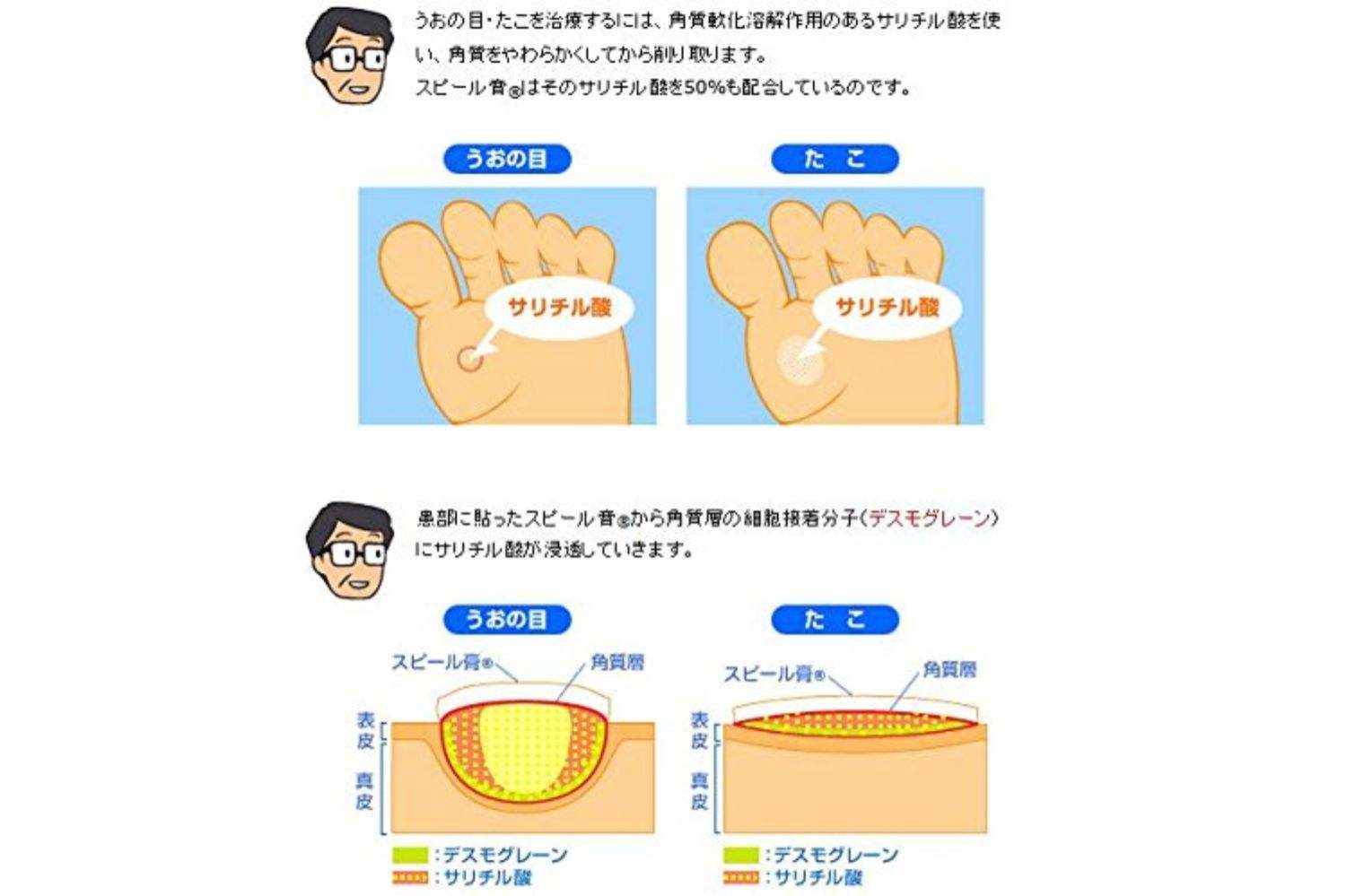 如何使用鸡眼贴,如何使用鸡眼贴视频
