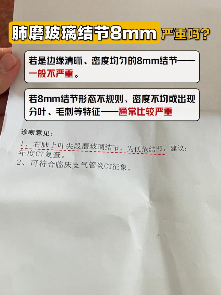 肺部磨玻璃结节7mm怎么办?,肺部磨玻璃结节7mm是什么意思严重吗