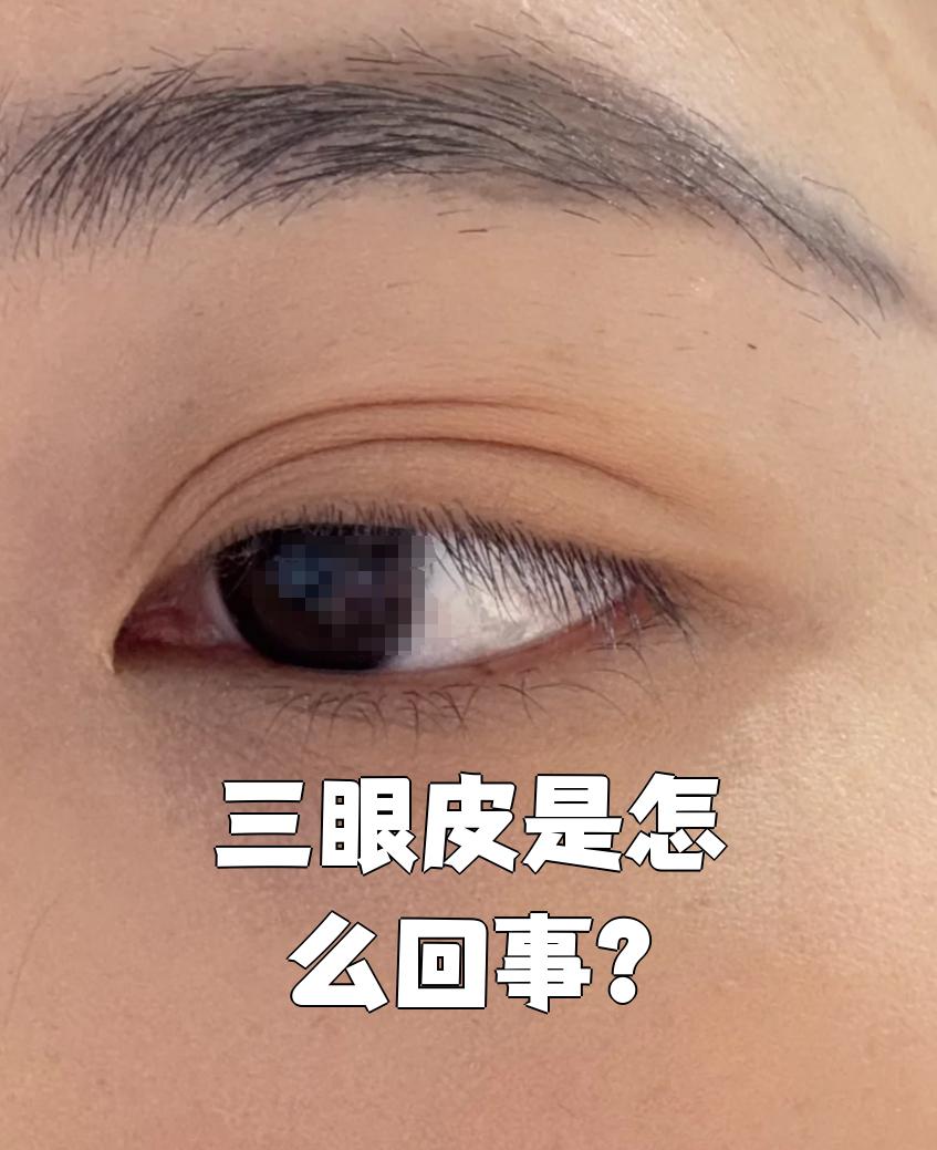 三眼皮代表什么命,三眼皮代表什么命儿童