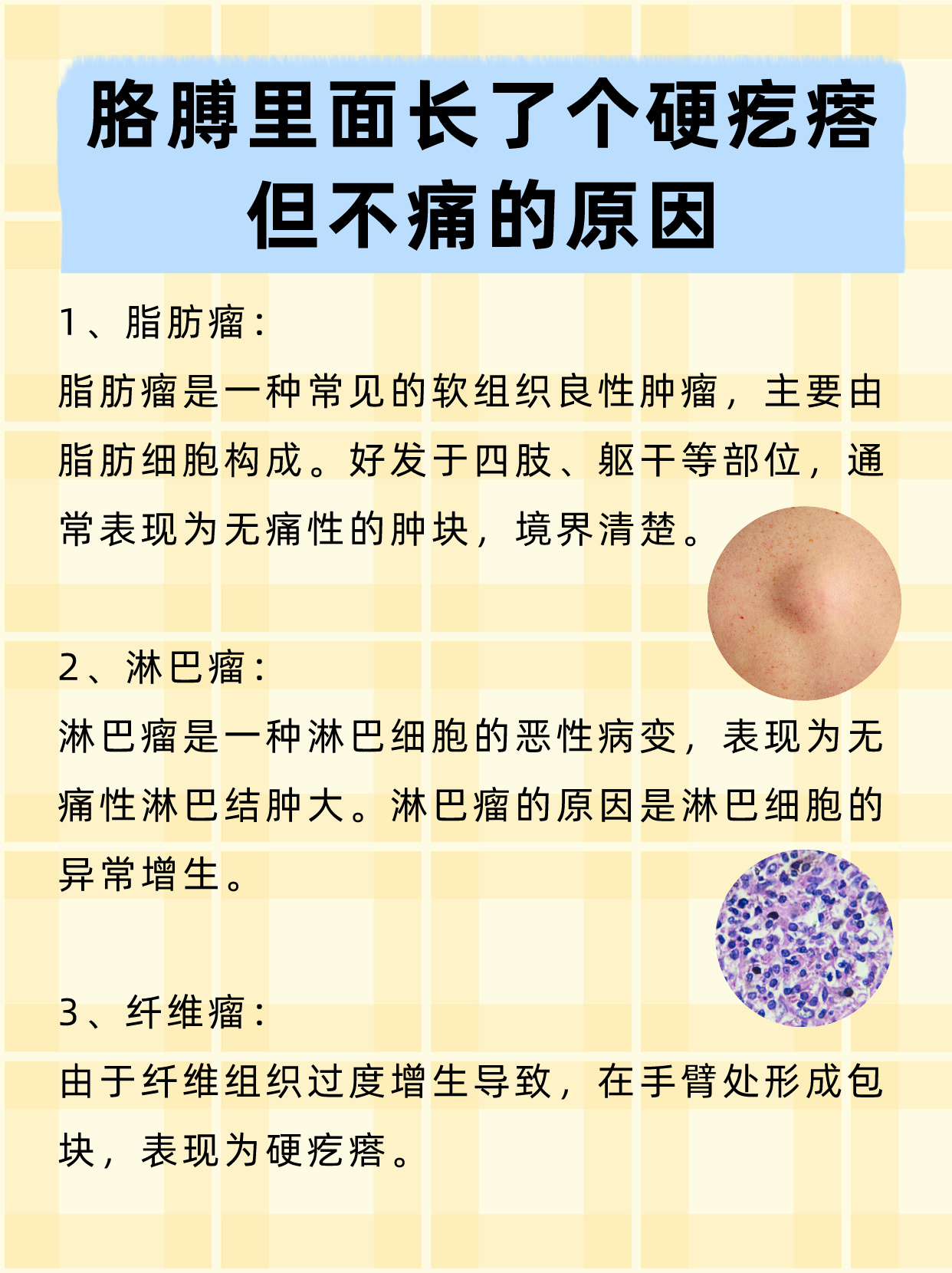 不痛不痒的意思是什么,不疼不痒的意思解释