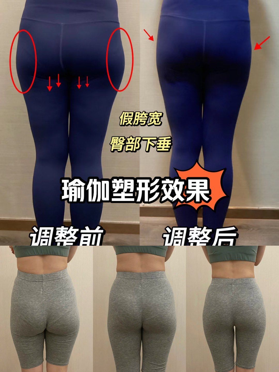 瘦假胯宽最有效的方法,瘦假胯骨的最快方法图解