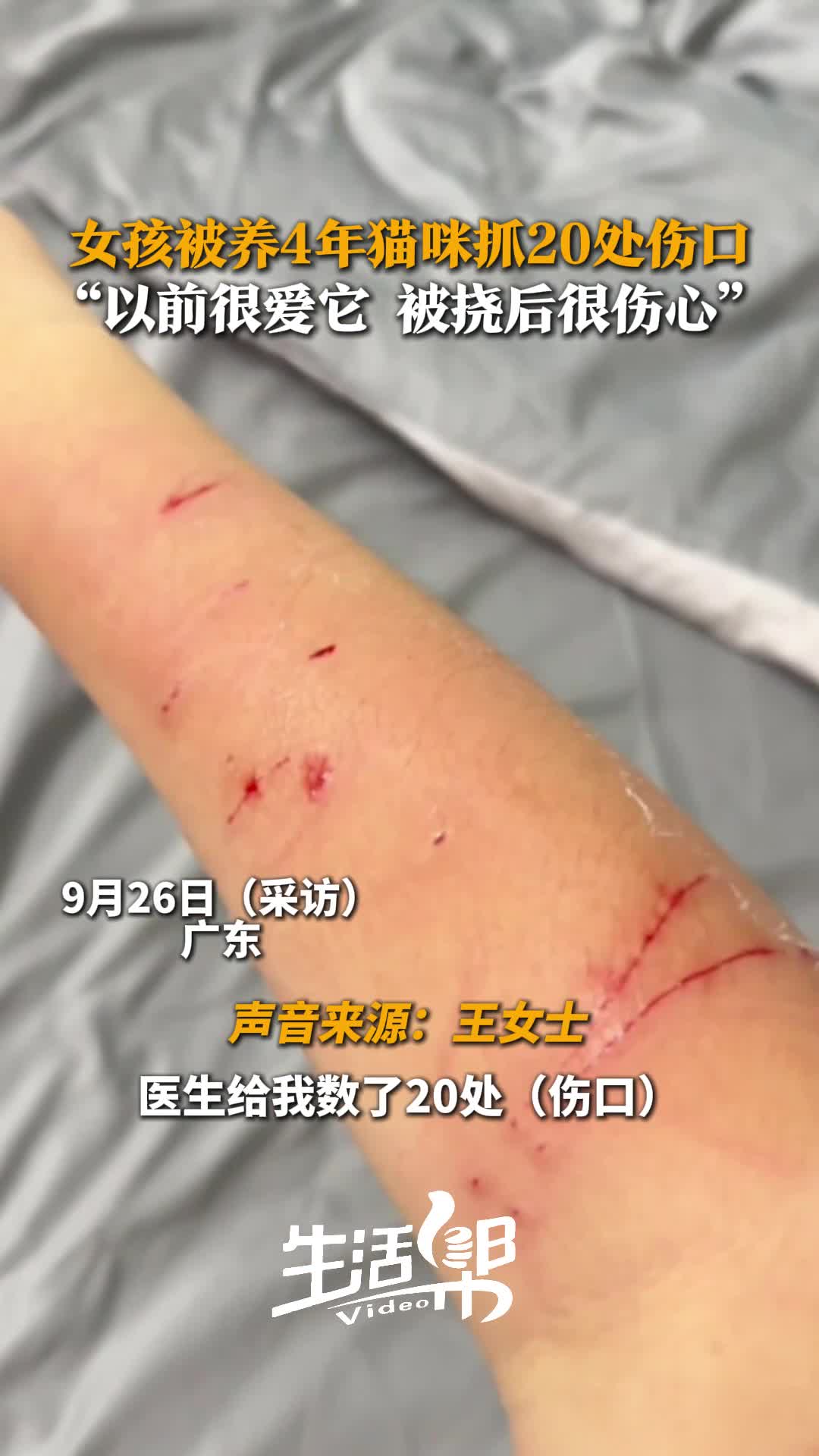 梦见被猫抓伤是什么预兆,怀孕梦见被猫抓伤是什么预兆