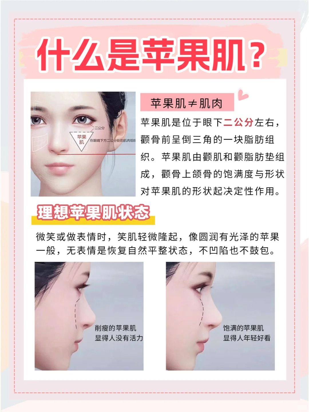 苹果肌长在什么地方,苹果肌到底在什么位置图片