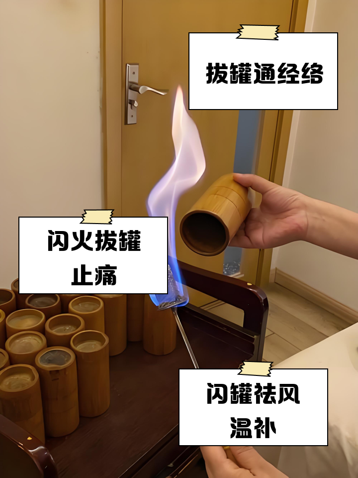 拔火罐的方法,老式拔火罐的方法
