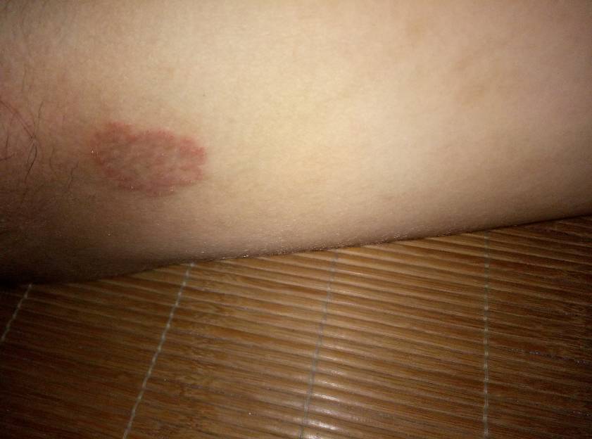 不痛不痒是什么意思,不疼不痒的人是什么意思