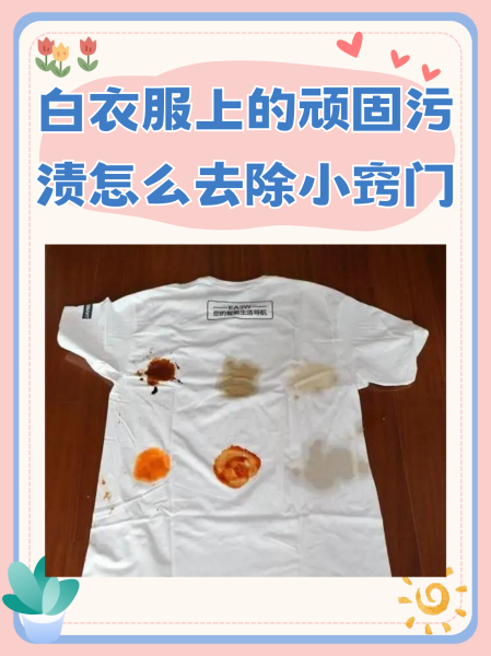 白色衣服上的污渍怎么才能去掉?,白色衣服的污渍怎么去除小窍门
