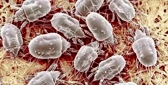 花露水能杀死螨虫吗,床单有螨虫的6个迹象