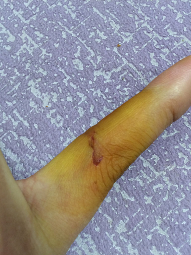 梦见被狗咬了手,梦到被猫咬是什么征兆女性周公解梦