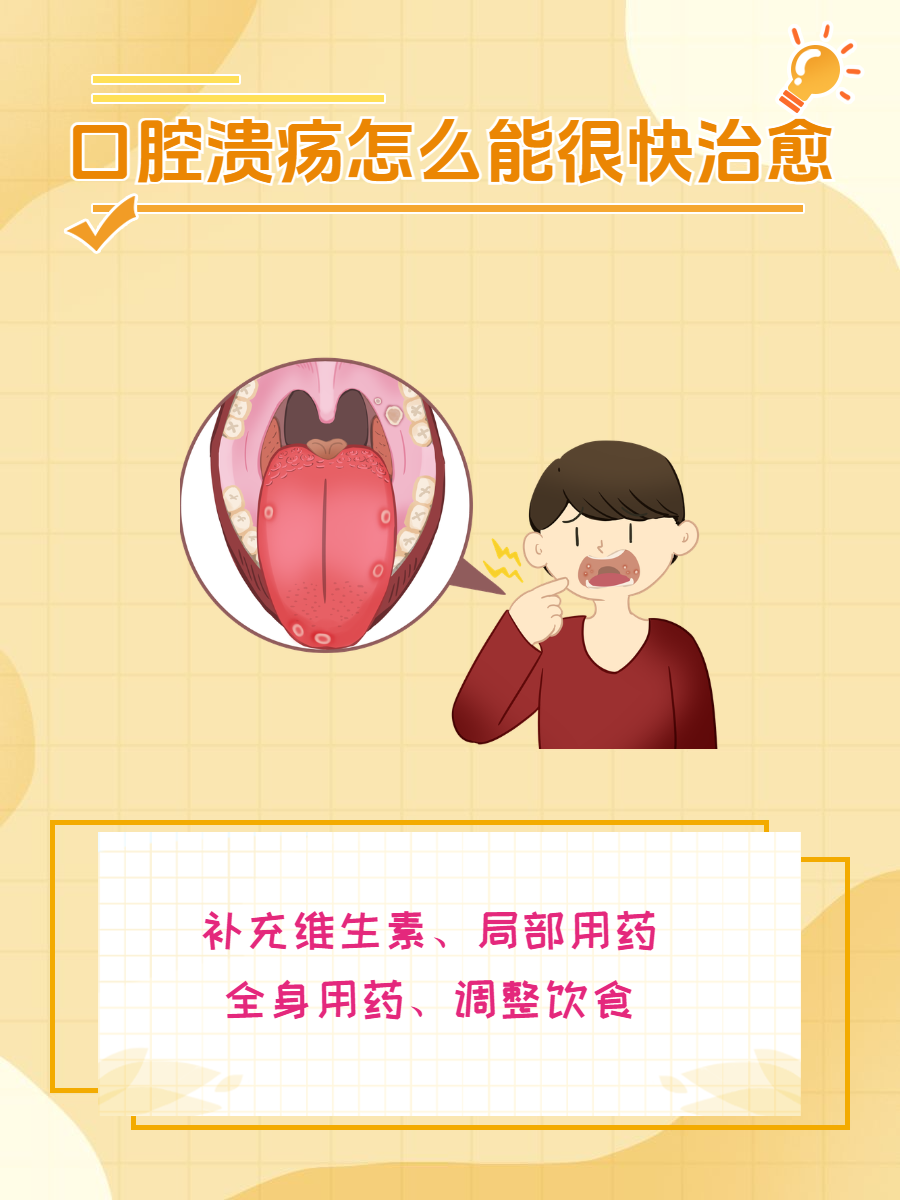 怎么快速治愈口腔溃疡,怎么快速治愈口腔溃疡小妙招